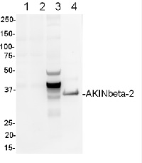 AKINB2 | SNF1-related protein kinase regulatory subunit beta-2 in the group Antibodies Plant/Algal / Plant Developmental Biology / Plant Signal Transduction at Agrisera AB (Antibodies for research) (AS09 462)